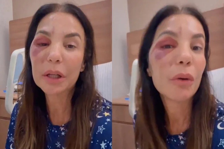 Ivete Sangalo fala pela 1ª vez sobre rumores de agressão