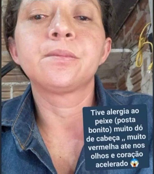 Peixe distribuído na Semana Santa causa mal-estar e leva moradores ao hospital no interior do RN