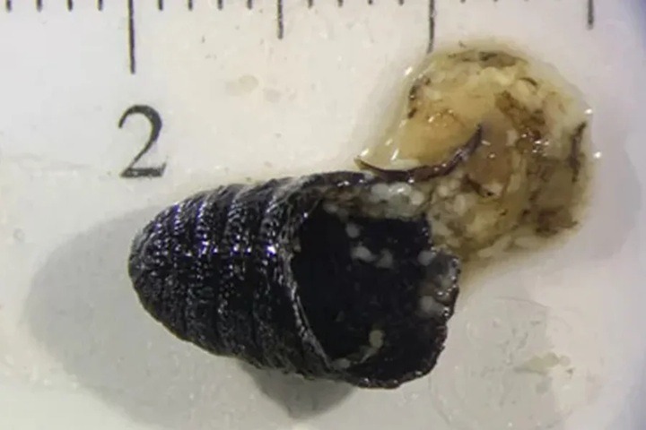 Com infecção rara, mulher espirra larvas e pupa de mosca