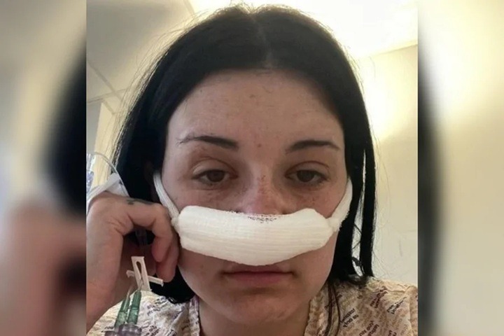 Mulher descobre tumor cerebral após sintomas tratados como estresse