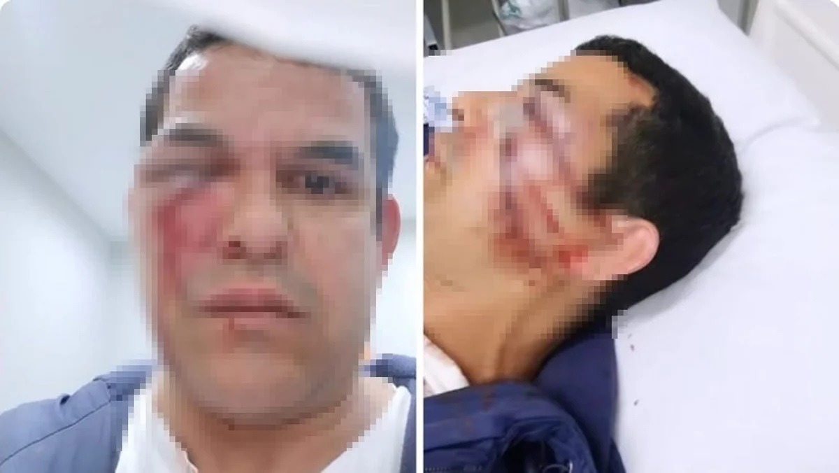 Vendedor é espancado por seis homens após ser chamado de "voz de bichinha"