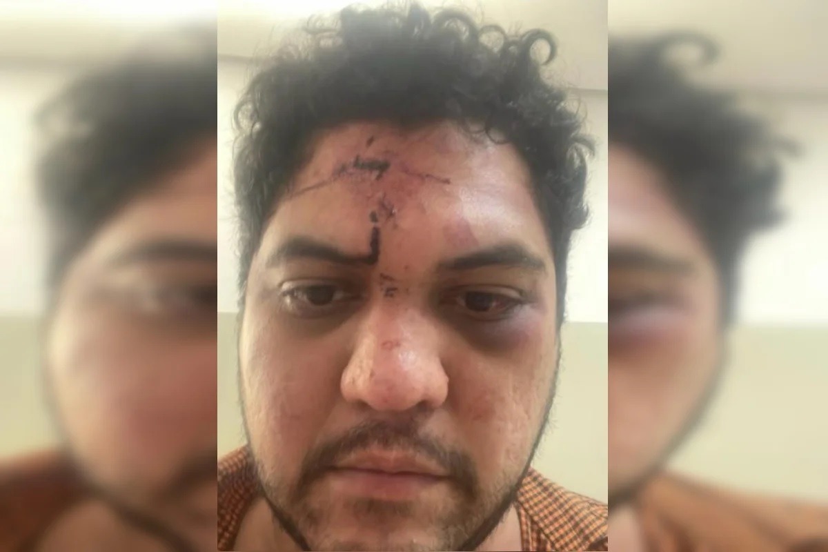 Advogado que viralizou após levar tapa em audiência é espancado por grupo