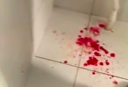 [VÍDEO] Homem agride enfermeiro de UPA em Natal, é solto e volta ao local, denunciam servidores