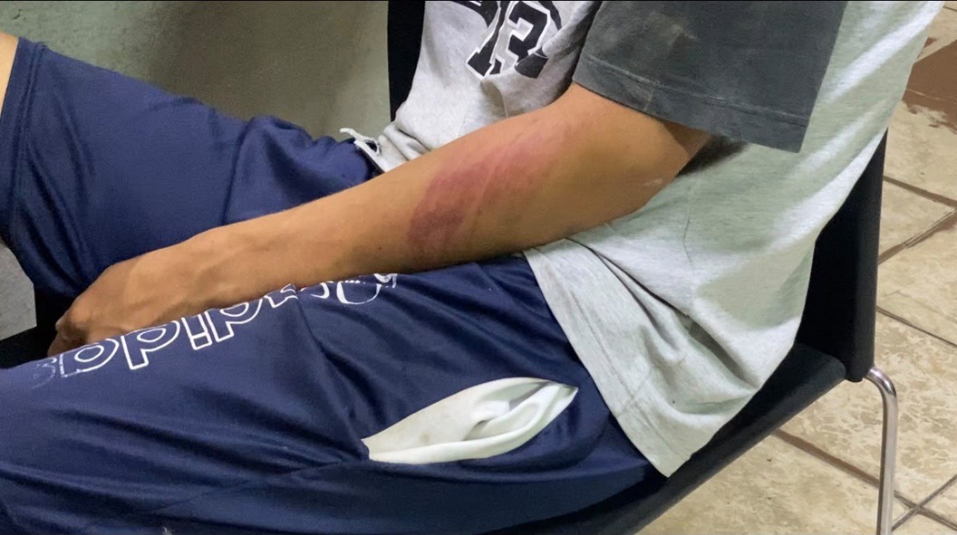 Jovem é resgatado após sequestro em Mossoró; suspeito morre em confronto com a PM
