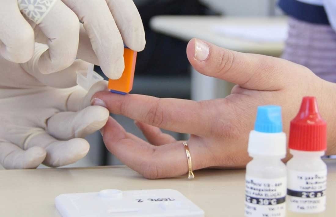 Casos de Infecções Sexualmente Transmissíveis disparam em Natal