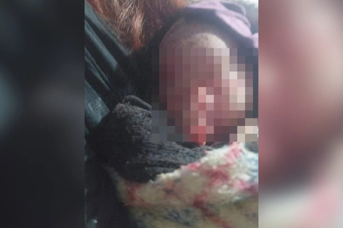 Mulher encontra recém-nascida no lixo: "Achou que era o gato chorando"