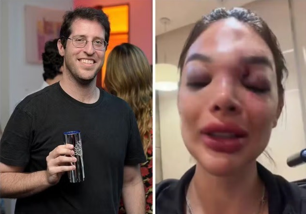 Dentista relata ao 'Fantástico' agressões que sofreu do marido, empresário da Faria Lima