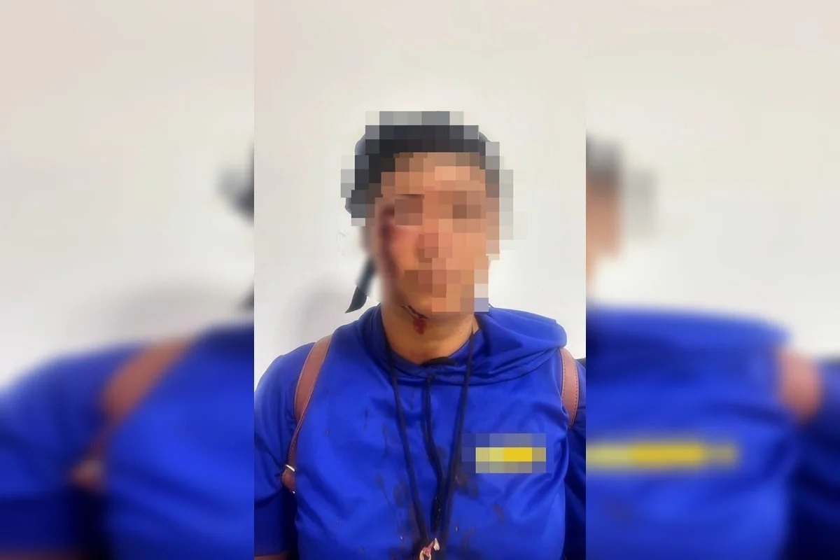 [VÍDEO] "Colocar pimenta no seu prikito", ameaçou agressora que chicoteou mulher