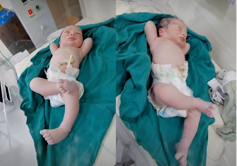 Bebê nasce fazendo pose de milionário, diverte os médicos e vídeo alcança 37 milhões