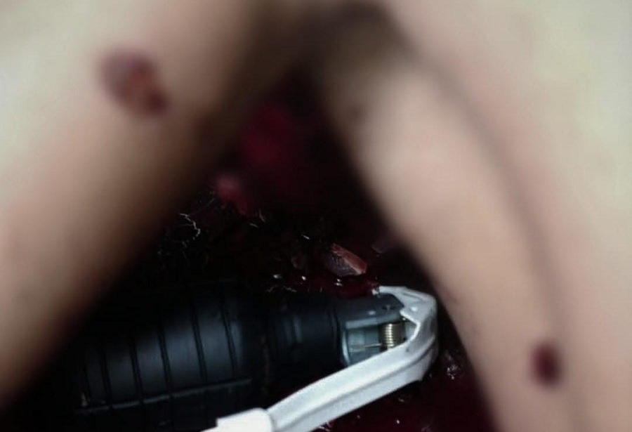 Esquadrão de Bombas encontra granada perto de corpo após homicídio em cidade do RN