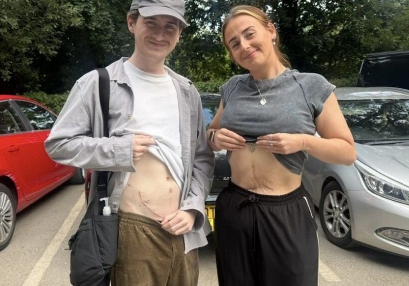 Jovem doa rim ao irmão com doença rara e função renal dele sobe de 5% para 67%
