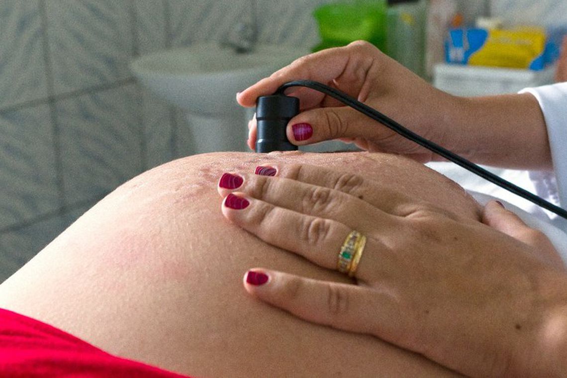 Anvisa emite alerta sobre uso de medicamento para náuseas por grávidas