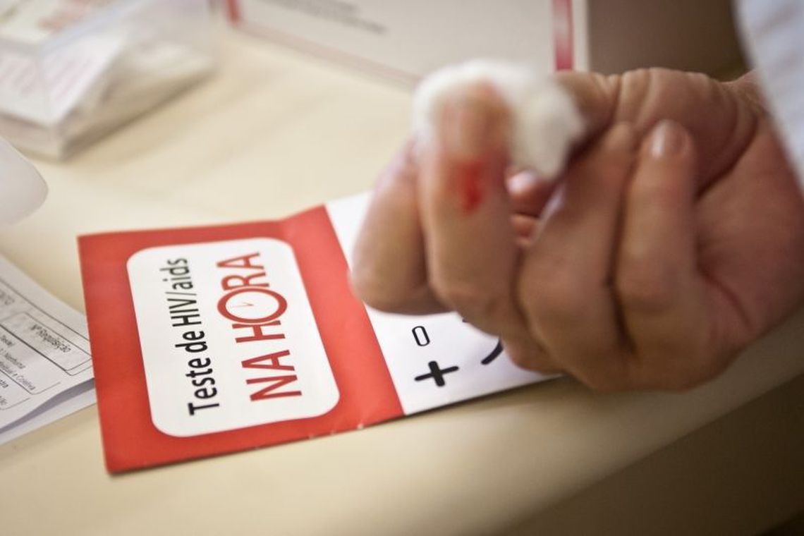 Ministério da Saúde: 135 mil convivem com HIV no país e não sabem