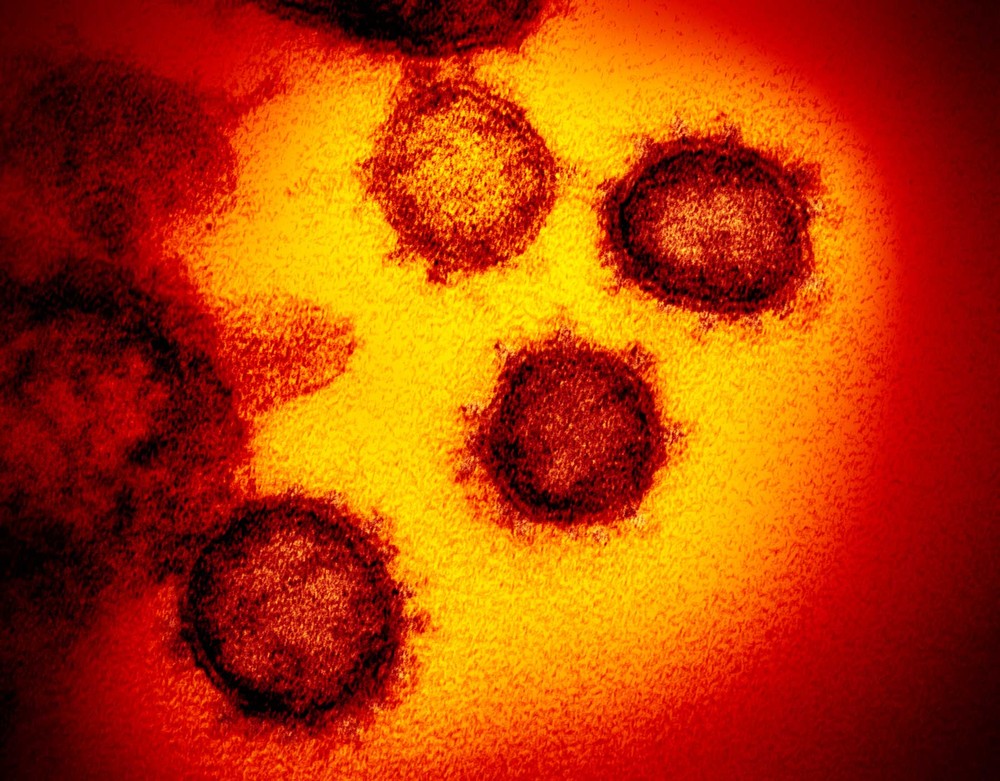 Confirmado no Brasil: Veja como se prevenir do novo coronavírus