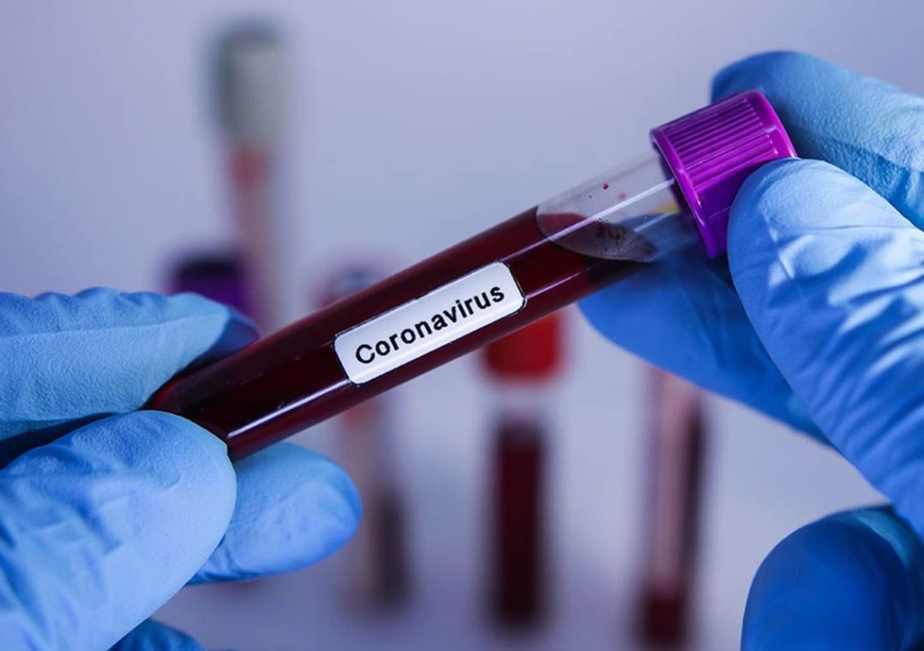 Fake: Notícia de vacina contra coronavírus produzida por Cuba é falsa