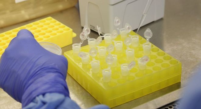 Casos suspeitos de coronavírus quase dobram no RN de um dia para o outro
