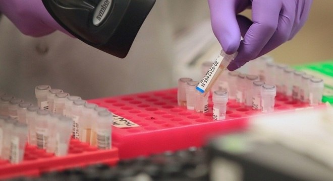 RN chega a quase 100 casos confirmados de coronavírus em 14 cidades