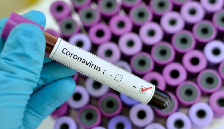 Coronavírus: Brasil tem novo recorde de mortes confirmadas em 24h; veja os dados