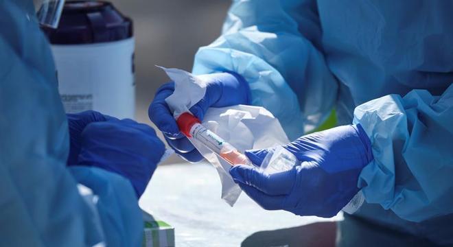 Brasil registra mais 263 mortes por Covid-19 em 24h; veja dados atualizados