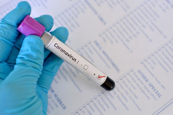 RN tem 160 mortos por coronavírus; veja dados atualizados