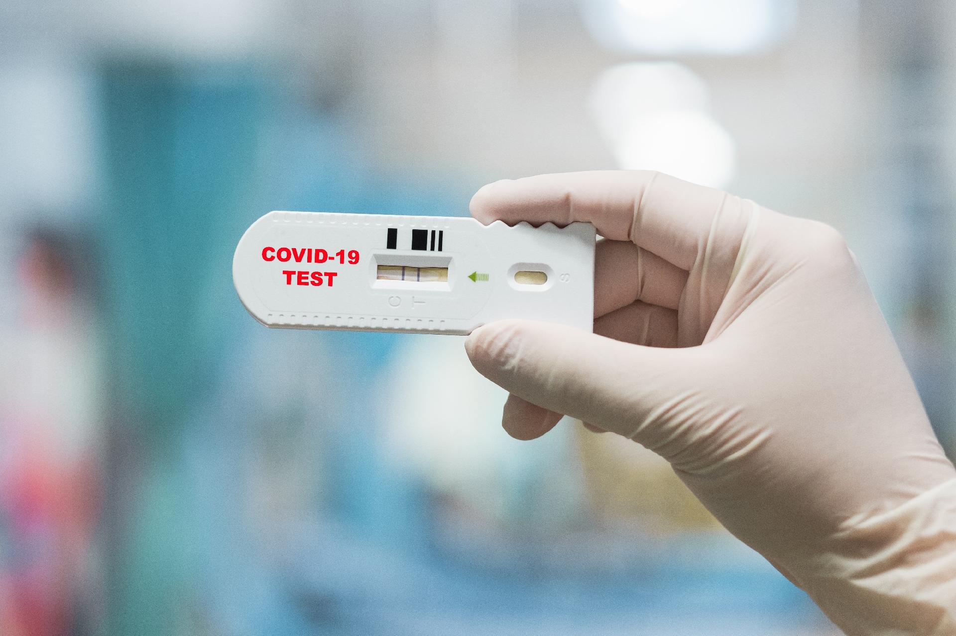 Obrigatório: ANS coloca teste de Covid na lista de cobertura dos planos de saúde