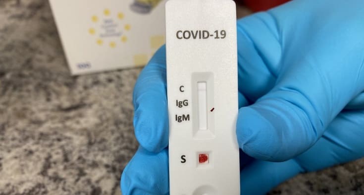 Covid-19: RN tem 2 óbitos nas últimas 24h; outros 218 estão em investigação