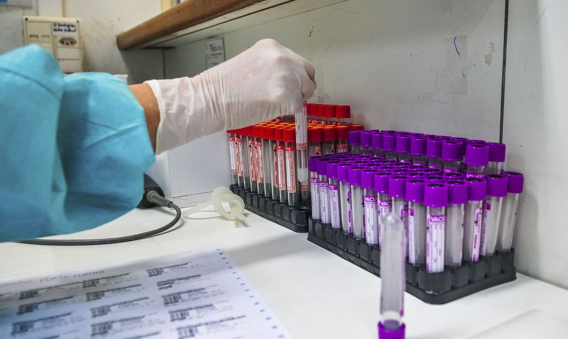 Covid-19: UFRJ desenvolve teste sorológico 20 vezes mais barato