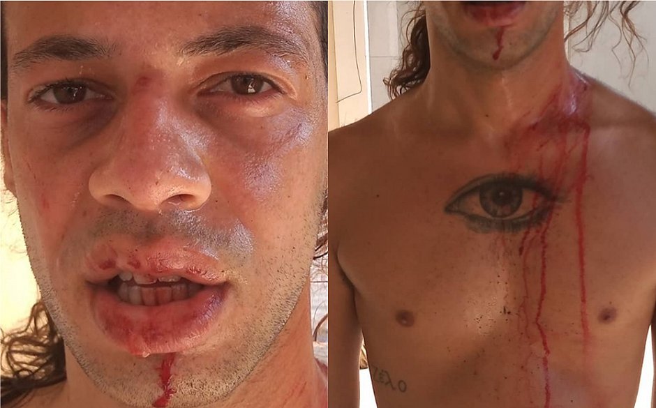 Irmão de repórter da Globo é agredido por 7 homens e denuncia homofobia