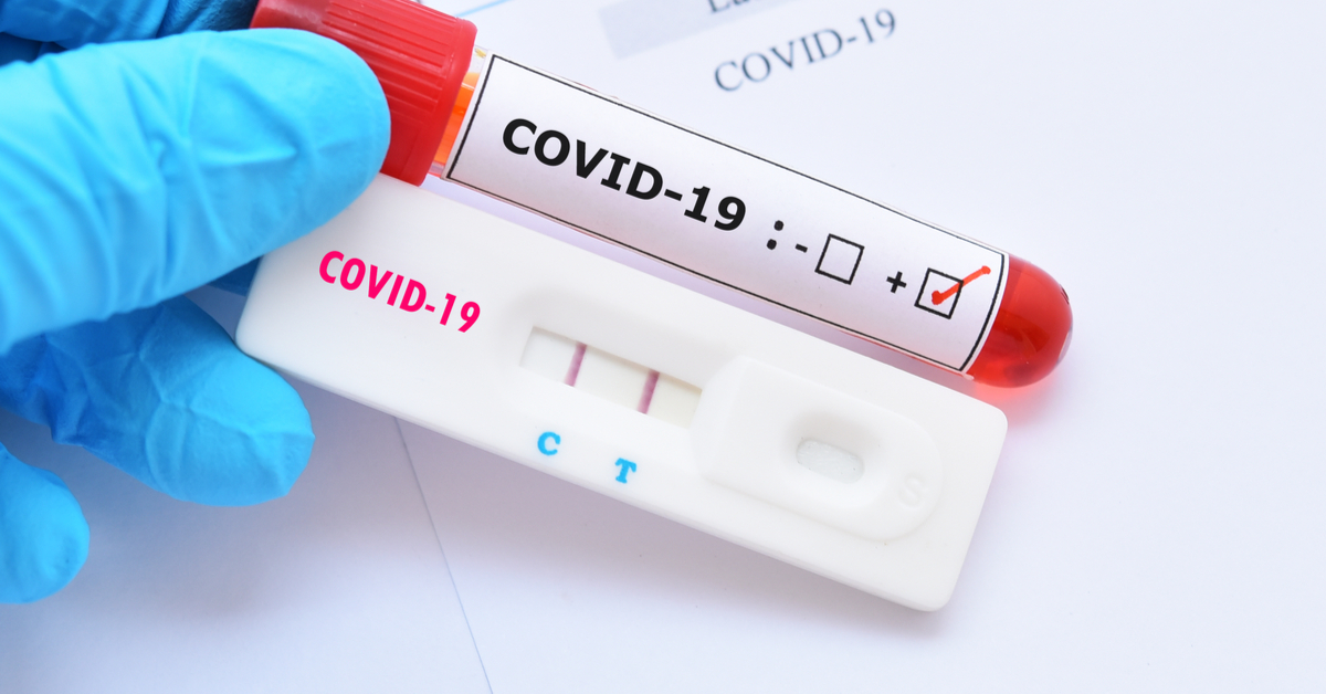 Brasil pode jogar no lixo 15 milhões de testes para Covid-19