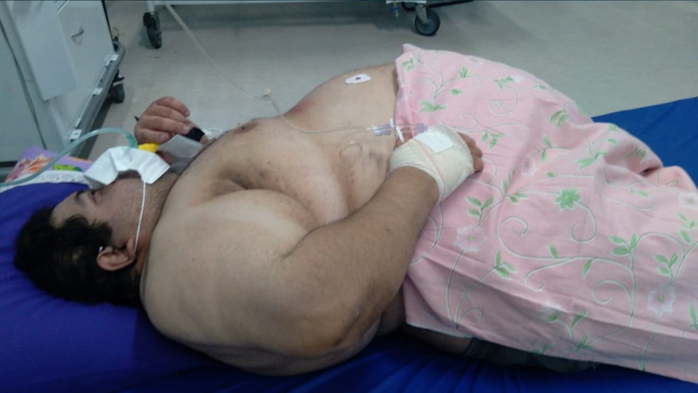 Morre em Natal paciente com 300 kg que aguardou 5 dias por vaga em UTI no chão