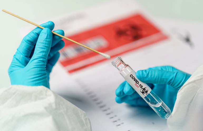 Covid-19: RN tem 174 novos casos; ocupação nos hospitais ultrapassa 60%