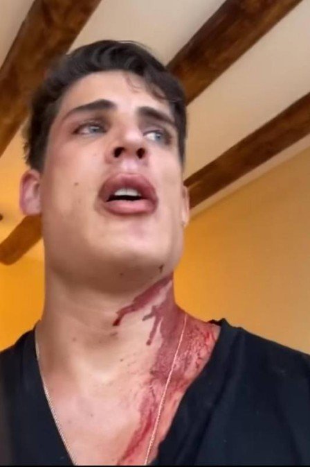 Affair da mãe de Neymar surge coberto de sangue e diz que levou facada