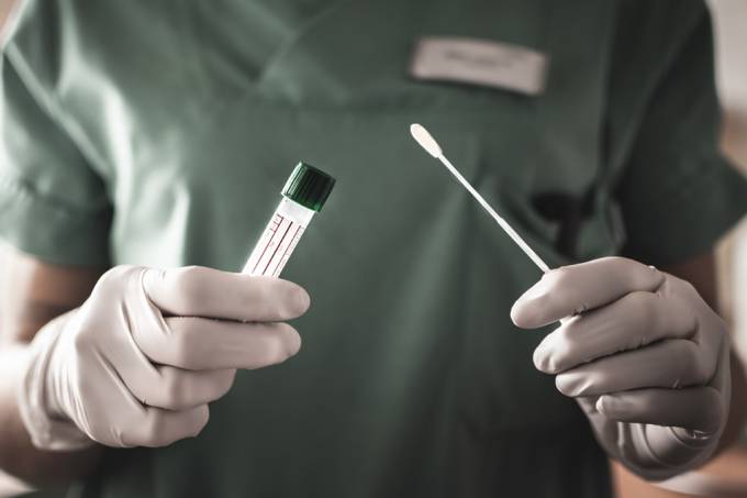 Anvisa estende prazo de validade de testes de covid-19