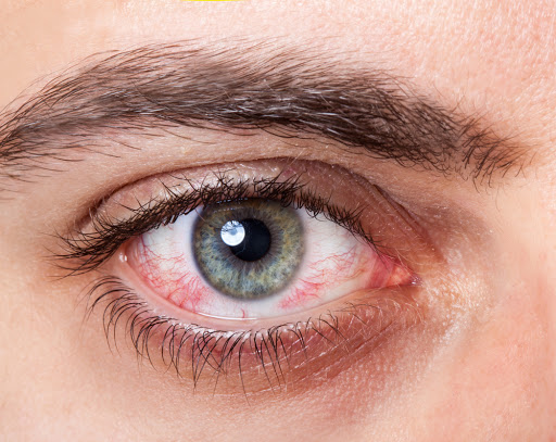 Olhos podem sinalizar risco de infecção pelo coronavírus; entenda