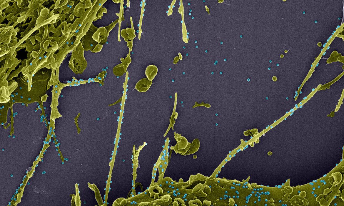 Estudo constata infecção simultânea por duas linhagens do coronavírus no Brasil