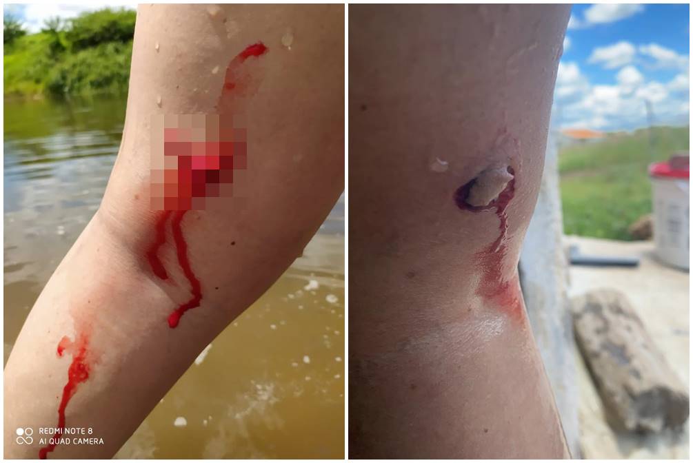 Casal é atacado por piranhas em rio no interior do RN
