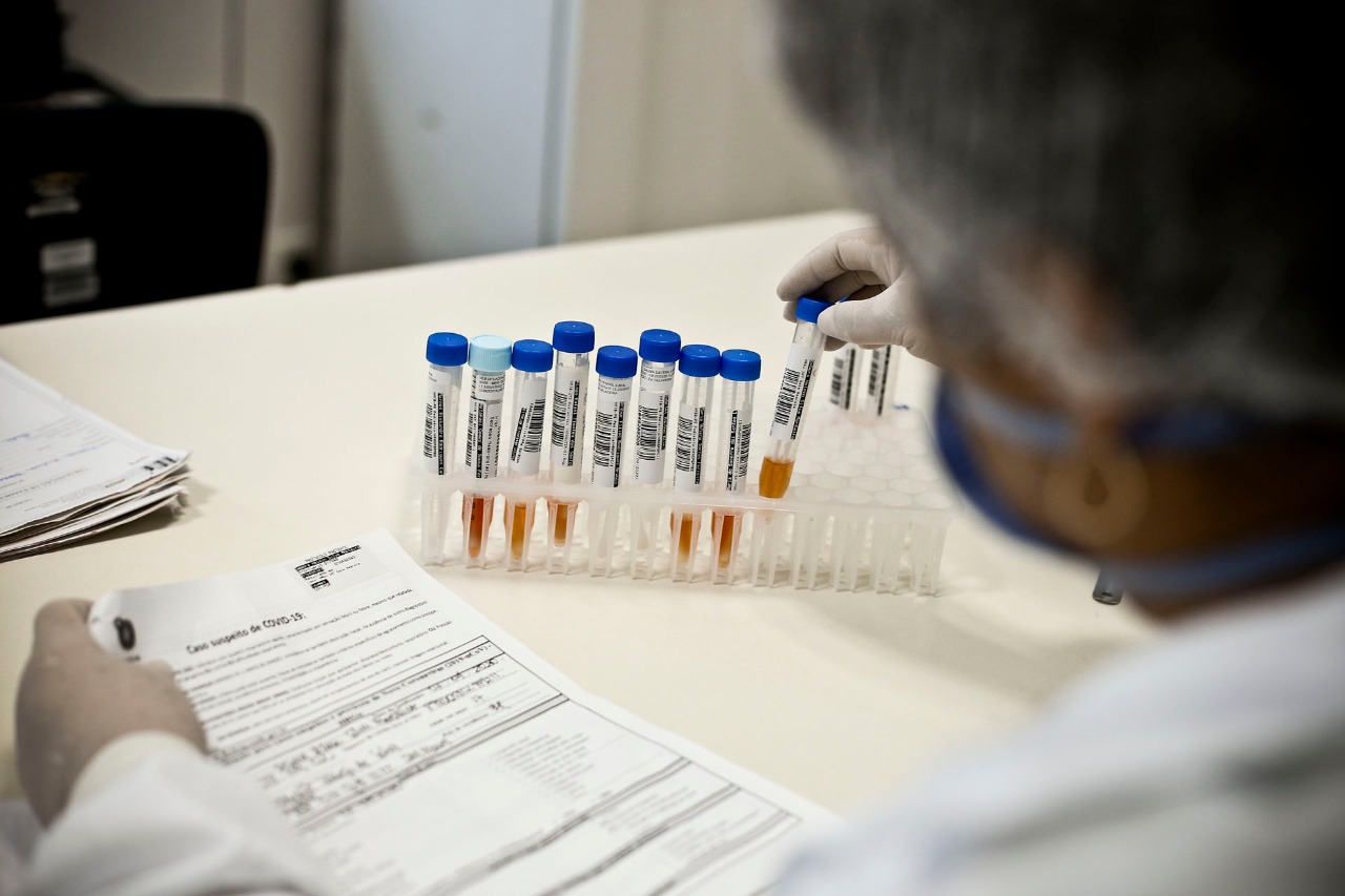 ANS: Planos de saúde terão que autorizar testes de covid-19 de forma imediata