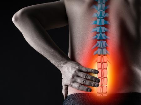 Saiba como exercícios podem ajudar na prevenção e tratamento da hérnia de disco