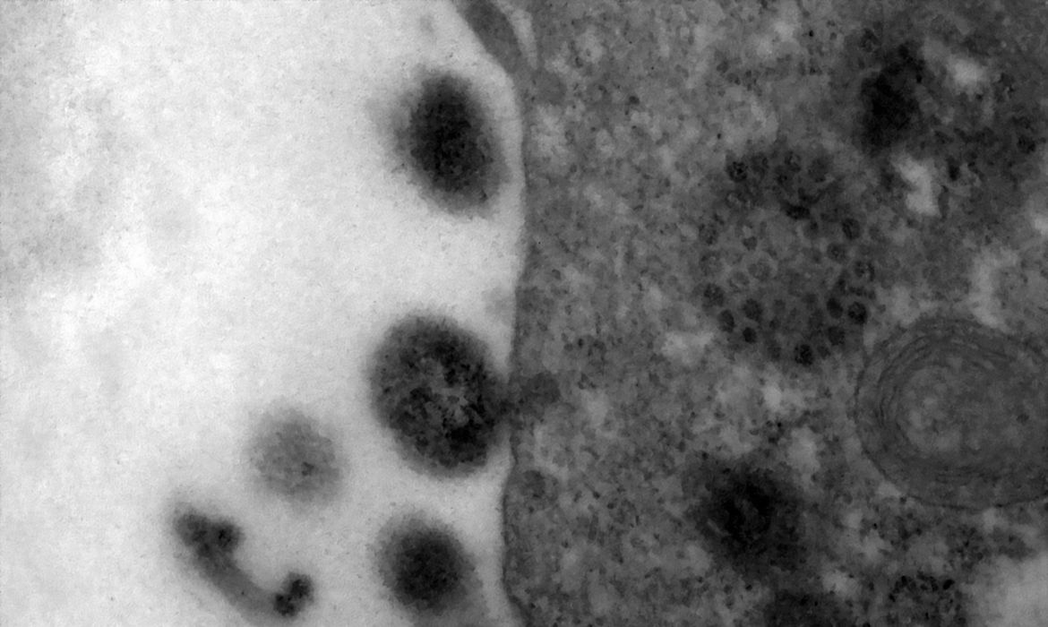 Covid-19: estudo mostra quanto tempo anticorpos podem durar após infecção