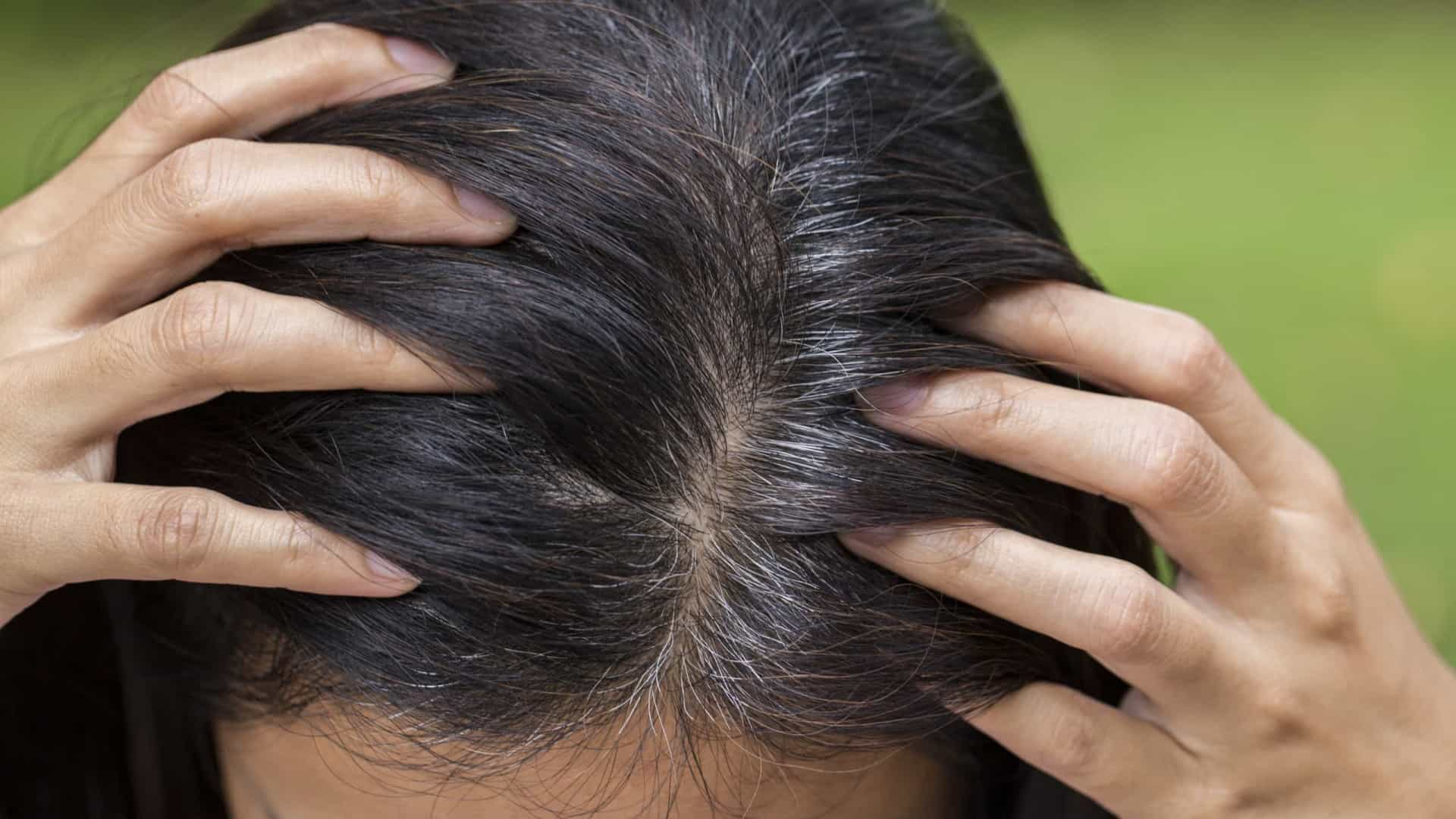 Cabelos brancos causados por stress podem ser revertidos, diz estudo