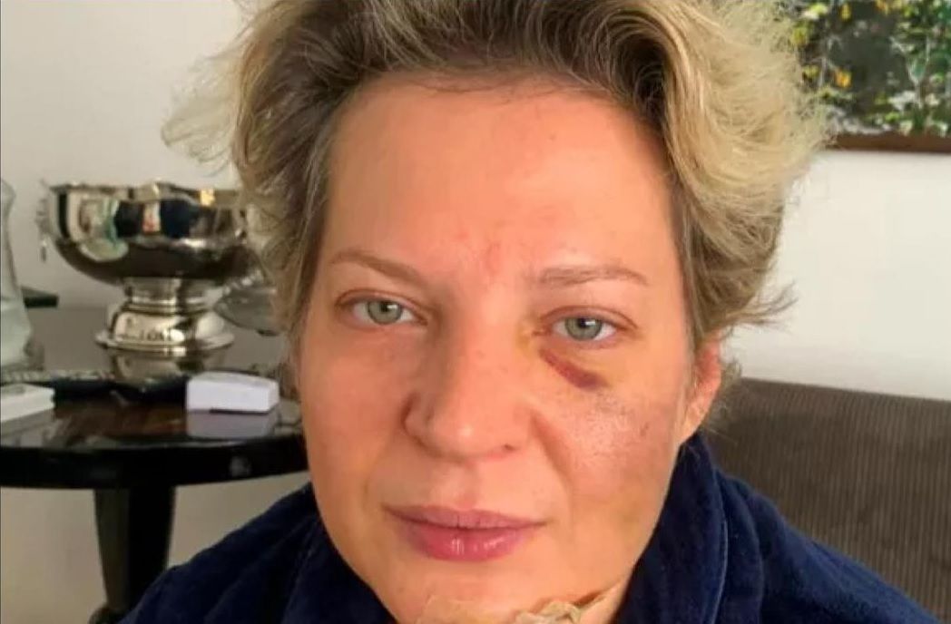 Joice diz suspeitar de duas pessoas depois de sofrer supostas agressões