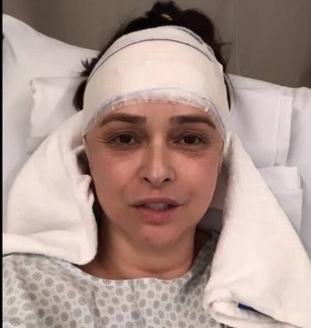 Atriz famosa passa por cirurgia de quatro horas na cabeça
