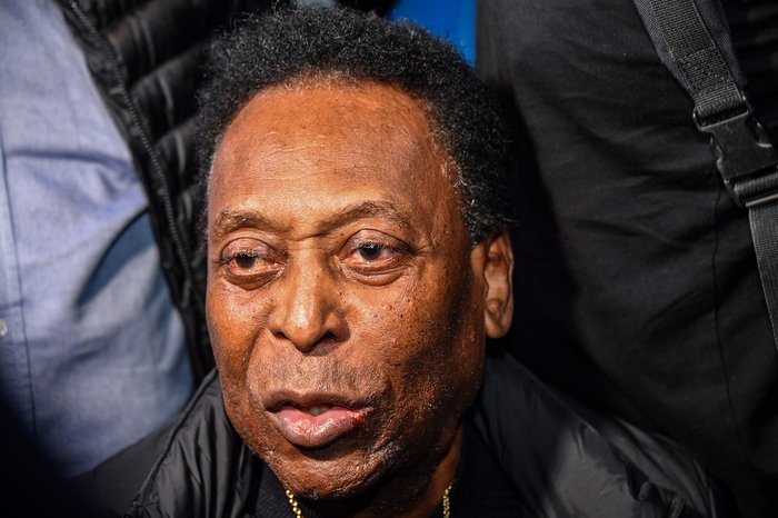 Pelé diz ter feito cirurgia no cólon para remover tumor suspeito