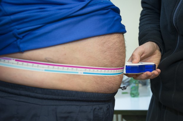 Projeto de extensão na UFRN abre “grupo de emagrecimento” para obesos e prevê perda de 300 kg em 12 semanas