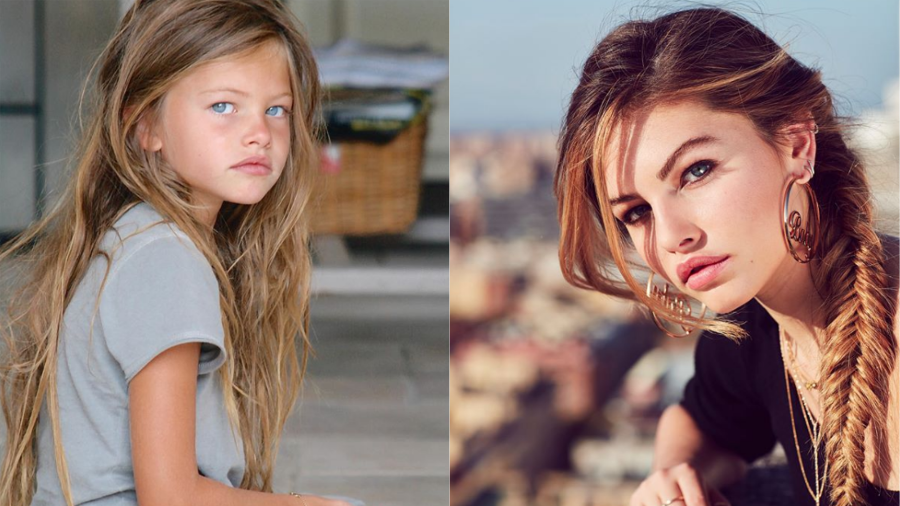 Garota que foi considerada a 'mais bonita do mundo' vive drama aos 20 anos
