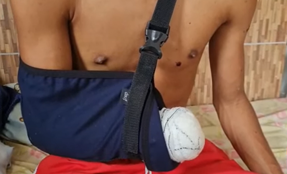 VÍDEO: Adolescente perde a mão ao confundir bomba com bola em Natal