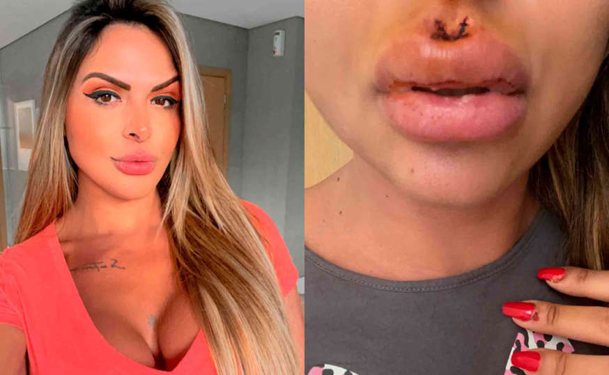 Apresentadora de TV mostra lesões causadas por agressão do ex-namorado; veja