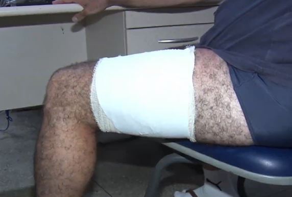 Turista de SP é baleado em tentativa de assalto quando voltava de lagoa na Grande Natal