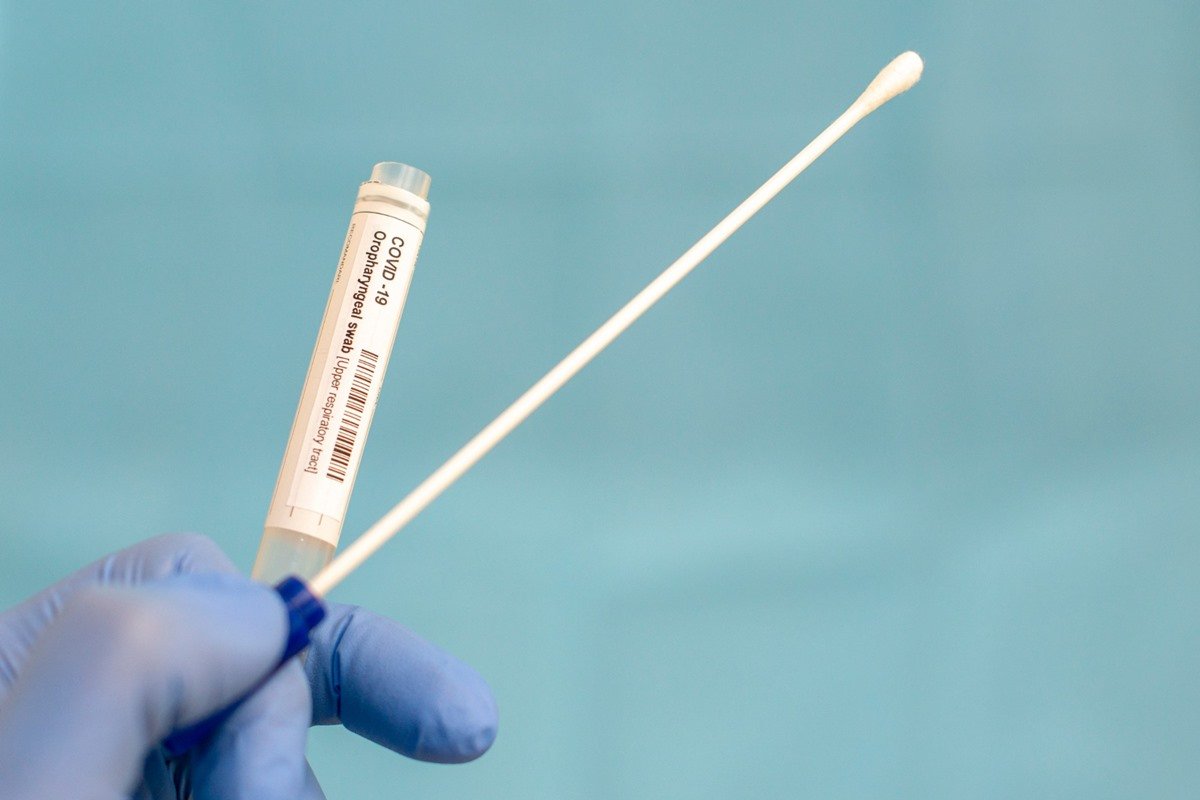Sesap confirma 1º caso de coinfecção de paciente com vírus da Influenza A e Covid-19 no RN