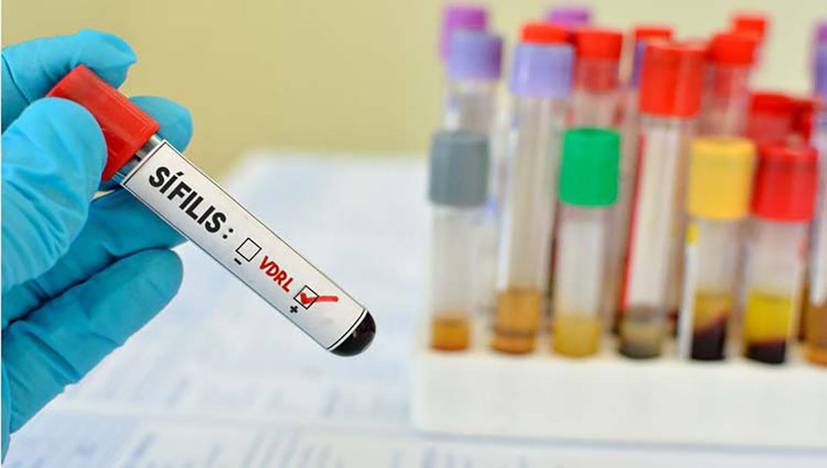 RN vive epidemia de sífilis com aumento de 809% na detecção de casos​